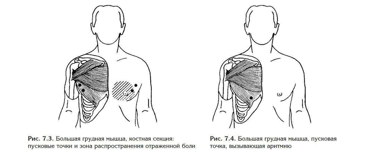 Является самой большой из четырех грудных мышц. Состоит из трех секций. Ключичная (верхняя) крепится к ключице, грудная (средняя) — к грудине, реберная (нижняя) — к мышцам ребер и желудка.-1-3