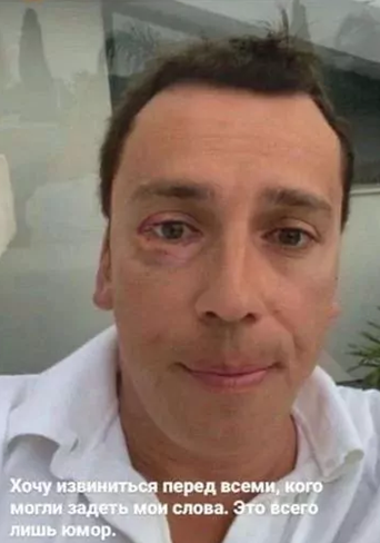 Подбитый артист