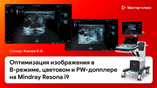 Оптимизация изображения в B-режиме, цветовом и PW-допплере на Mindray Resona i9