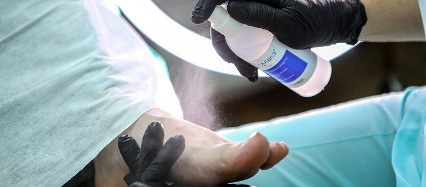 Подологи занимаются проблемами ногтей и кожи стоп. В том числе, удалением стержневых мозолей и бородавок.