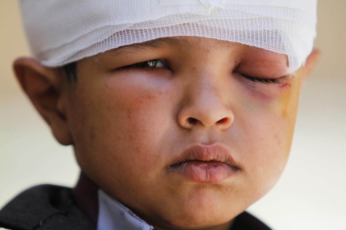 Жертва войны / Reuters