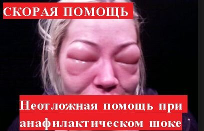 Внимание! Вся информация в видео только для ознакомительных целей! При возникновении каких либо симптомов вызывается скорая медицинская помощь! 