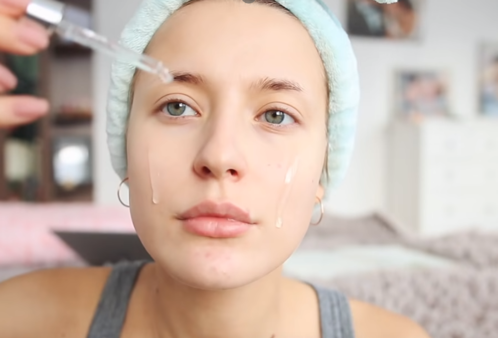 Советы по уходу за кожей с прыщами