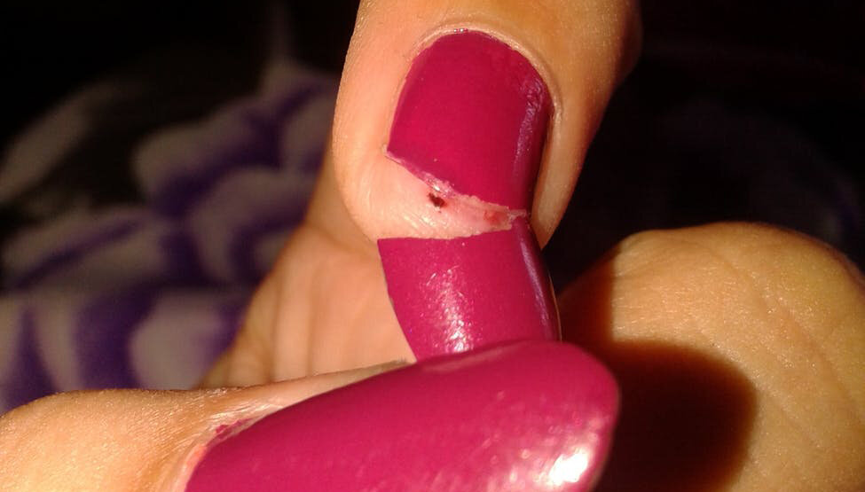 Сломаный ноготь