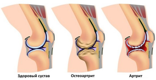 Заболевания колена | Prof. Dr. Engin Çakar