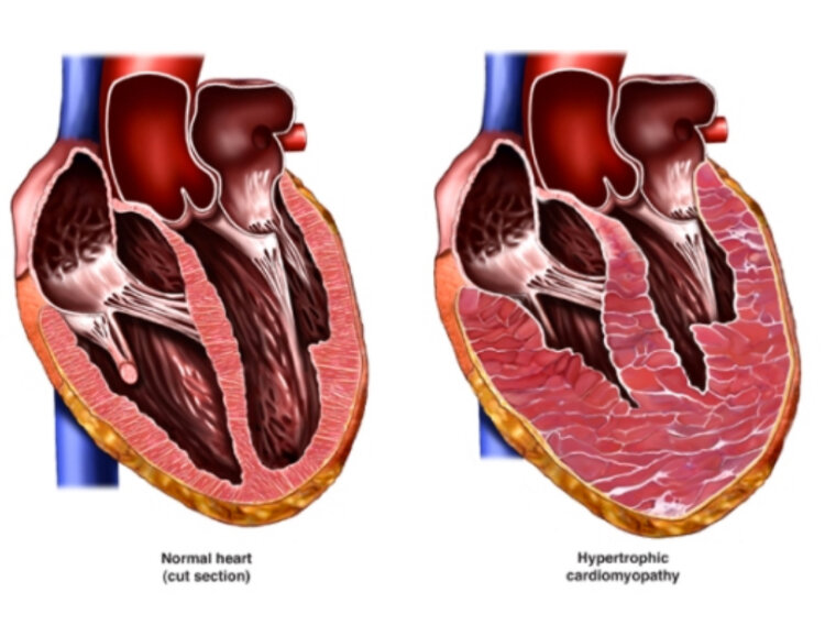 Источник - яндекс картинки.
