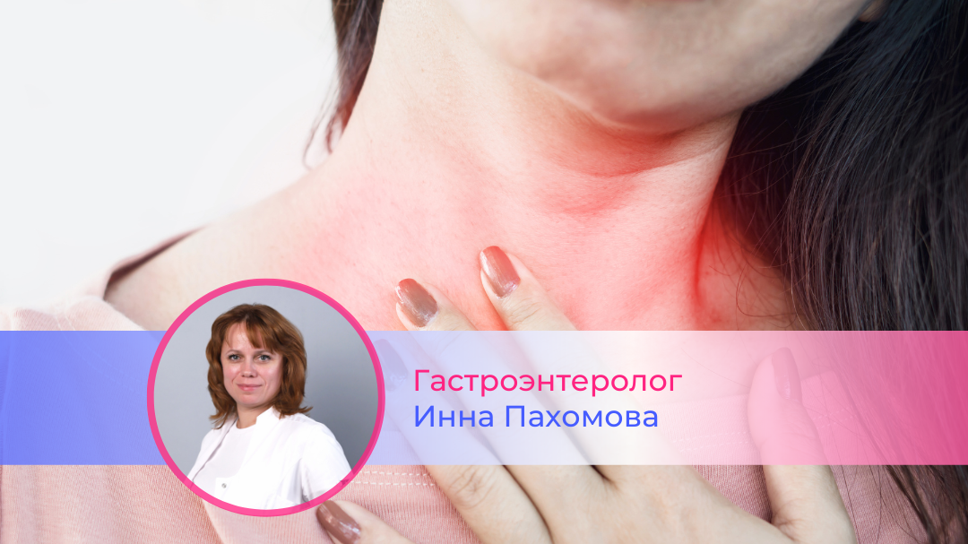 Об изжоге от врача гастроэнтеролога, гепатолога высшей категории Инны ...