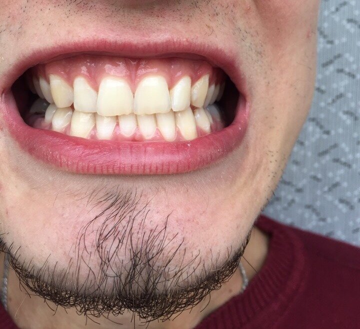 Фотография — До