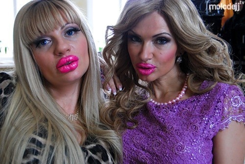 Увеличение губ – процедура, которой уже никого не удивишь. Каждая вторая женщина мечтает сделать губы более пухлыми и сексуальными. 