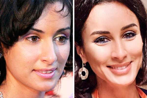 Тина Канделаки До пластики и после