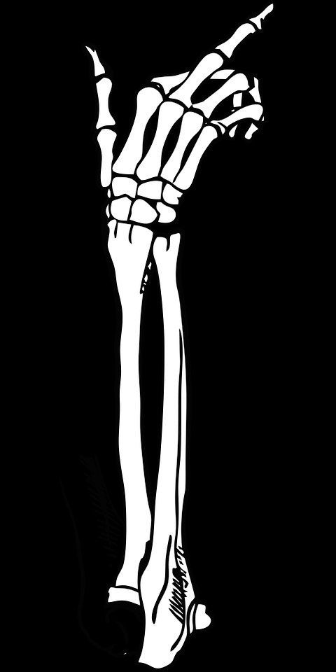 Так выглядит твоя фантомная рука, когда намекает, что будет болеть.