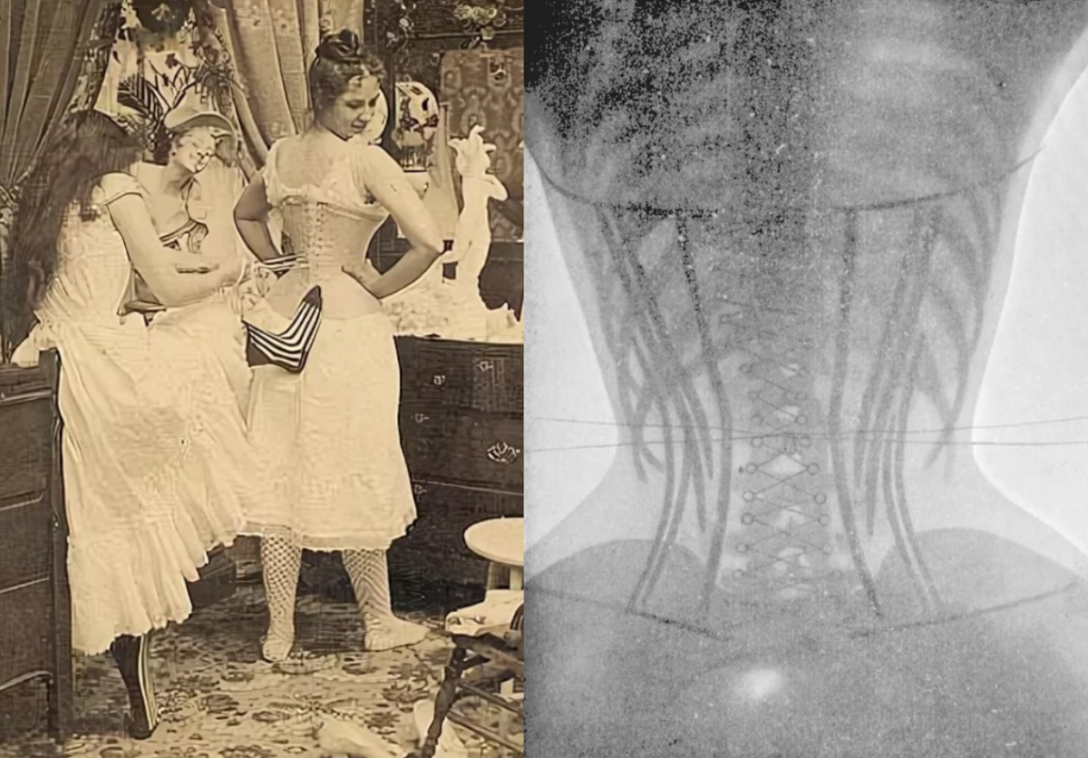 женские жертвы ради красоты. туфли лотос бинтование. жертва ради красоты фраза. паровая химическая завивка. золотой лотос ноги китай.