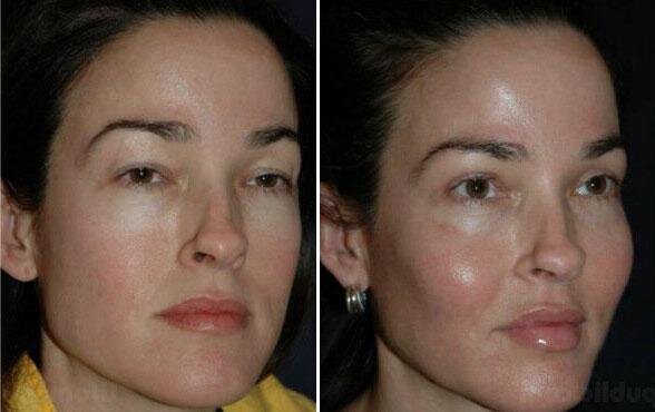 Фото: Яндекс Картинки