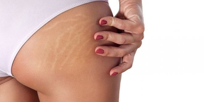 Фото взято из интернета 