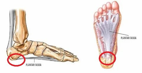 Бугор пяточной кости и прикрепляющаяся к нему плантарная связка(апоневроз или фасция)