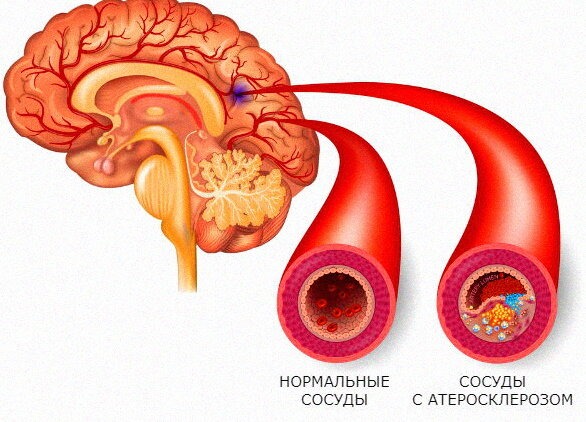 Яндекс.Картинки