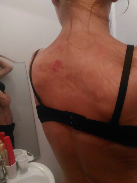 Я решила зафиксировать побои хотя бы для себя