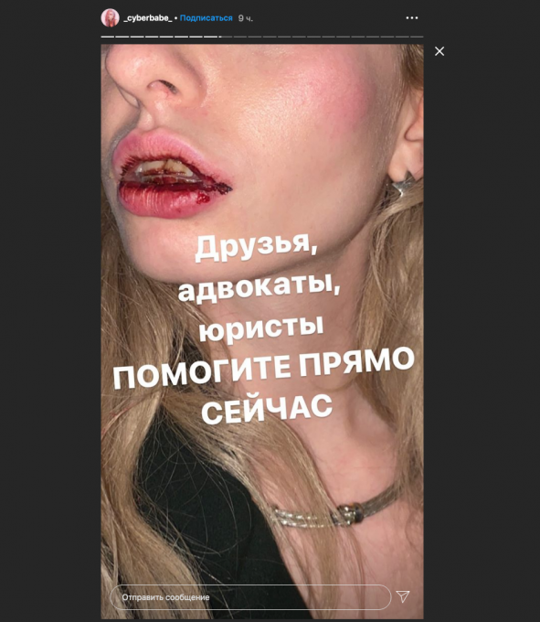 -2