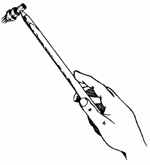 Рис.6 Правильный захват многоигольчатого молоточка.