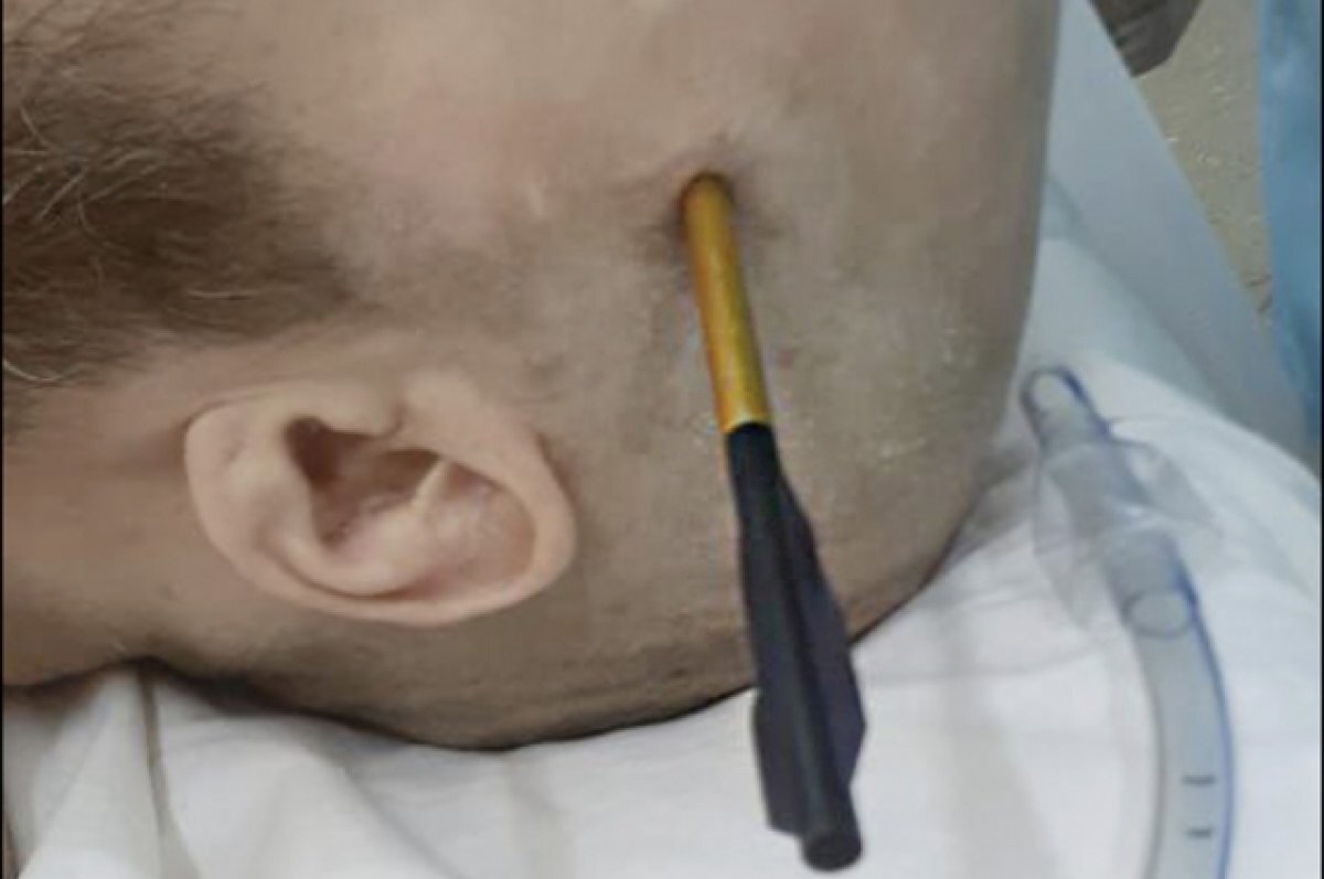    Друг попал из арбалета.