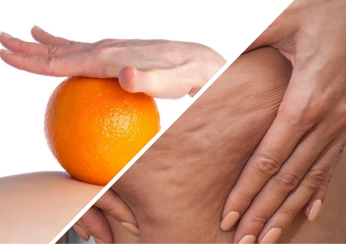 Фото https://versiya.info/zdorovye/120047