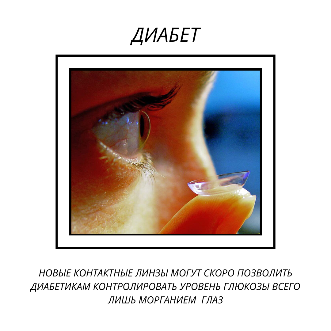 Контроль уровня глюкозы линзами