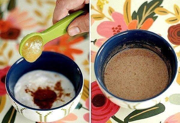 
 
Все ингредиенты предельно доступны, никакой экзотики. Выраженный разглаживающий эффект наступит уже после первой процедуры
 
Помни, что любая маска накладывается только на очищенную кожу! Некоторые компоненты средства могут вызвать аллергическую реакцию. 
 
ИНГРЕДИЕНТЫ 
 
✅3 ст. л. пищевой соды 
✅1 ч. л. мёда 
✅1 ч. л. жидкого витамина Е (продается в аптеках) 
✅1/4 ч. л. молотой корицы 
✅4 ч. л. молока или сливок 
 
📌ПРИГОТОВЛЕНИЕ 
 
1️⃣Смешай все ингредиенты: масса получится достаточно густой
2️⃣Нанеси маску толстым слоем на очищенную кожу лица и шеи, избегая области вокруг глаз и губ. Дай подсохнуть. 
 3️⃣Через 15–20 минут смой теплой водой, слегка растирая кожу

Смыв маску, ты сразу заметишь, что кожа заметно посвежела, посветлела, подтянулась, а поры очистились и сузились

Пользуйся этим средством 2 раза в неделю, чтобы как можно дольше окружающие не смогли угадать твой возраст!