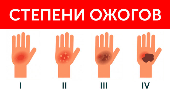 Как помогут профессионалы и другие люди?