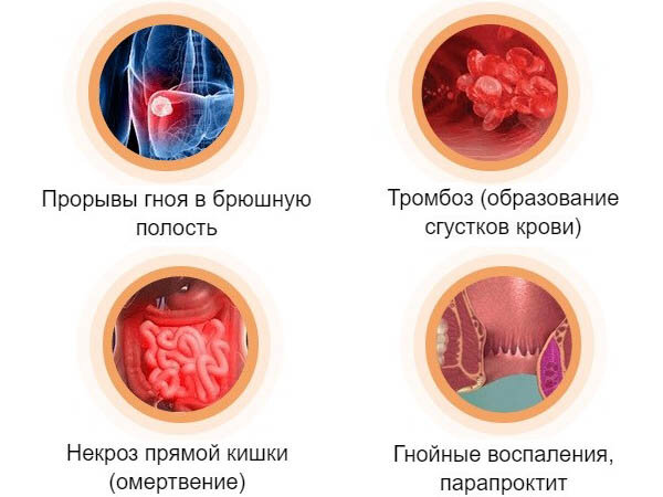 Психосоматика геморроя, как главная причина заболевания