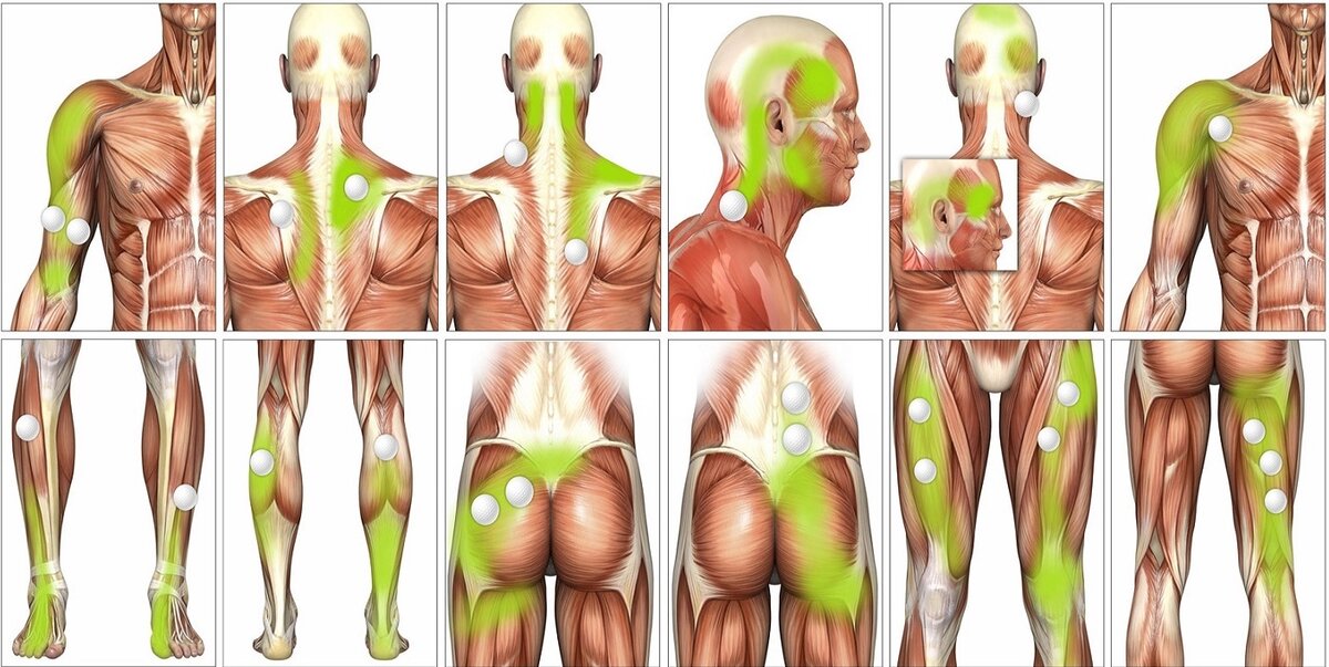 Триггерные точки на теле человека фото с описанием для снятия боли в плече