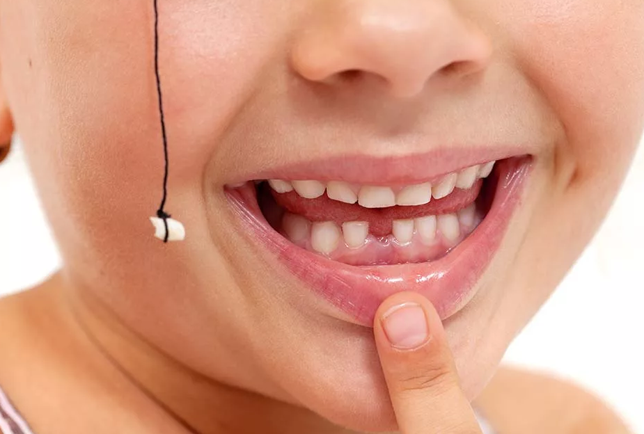 Как вырвать молочный зуб у ребенка дома — удаление зубов без боли самостоятельно
