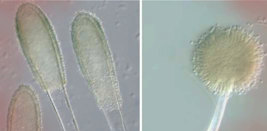 Aspergillus clavatus