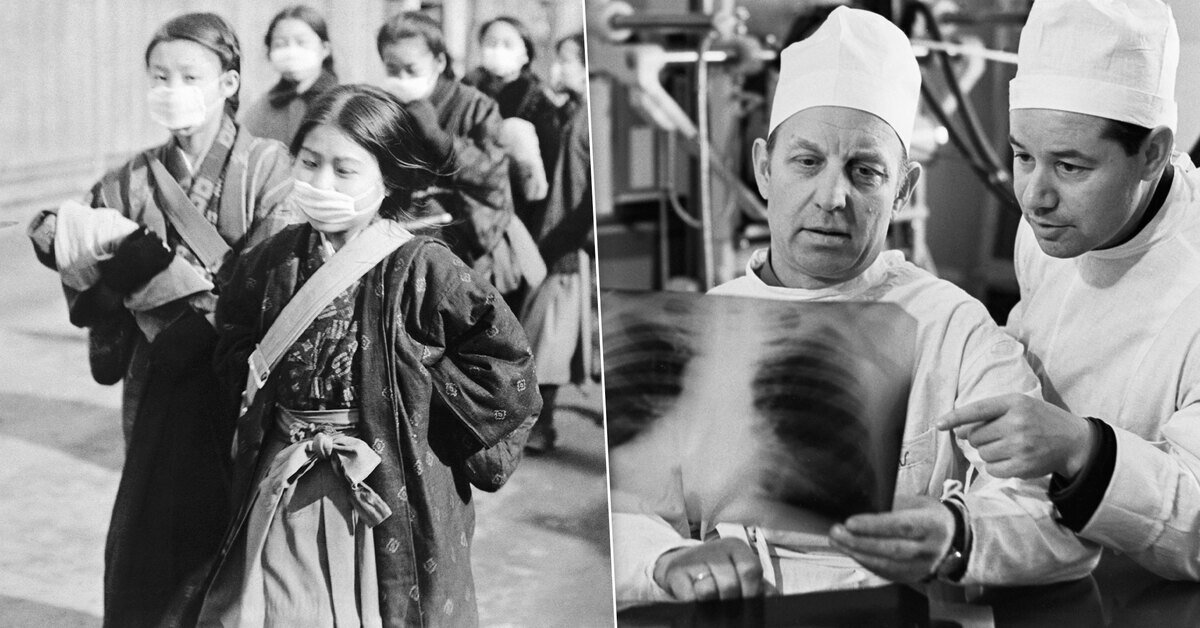 Грипп гонконг 2023 симптомы. Ссср грипп 1969 года. Грипп гонконг 2023 симптомы. Грипп h3n2. Гонконгский грипп 1968 1969 пандемия.