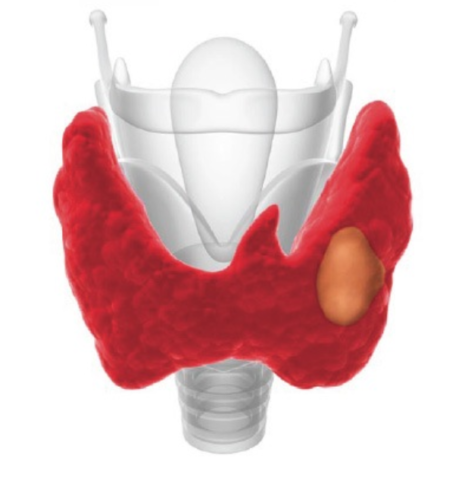 От работы щитовидки зависит скорость всех витальных процессов