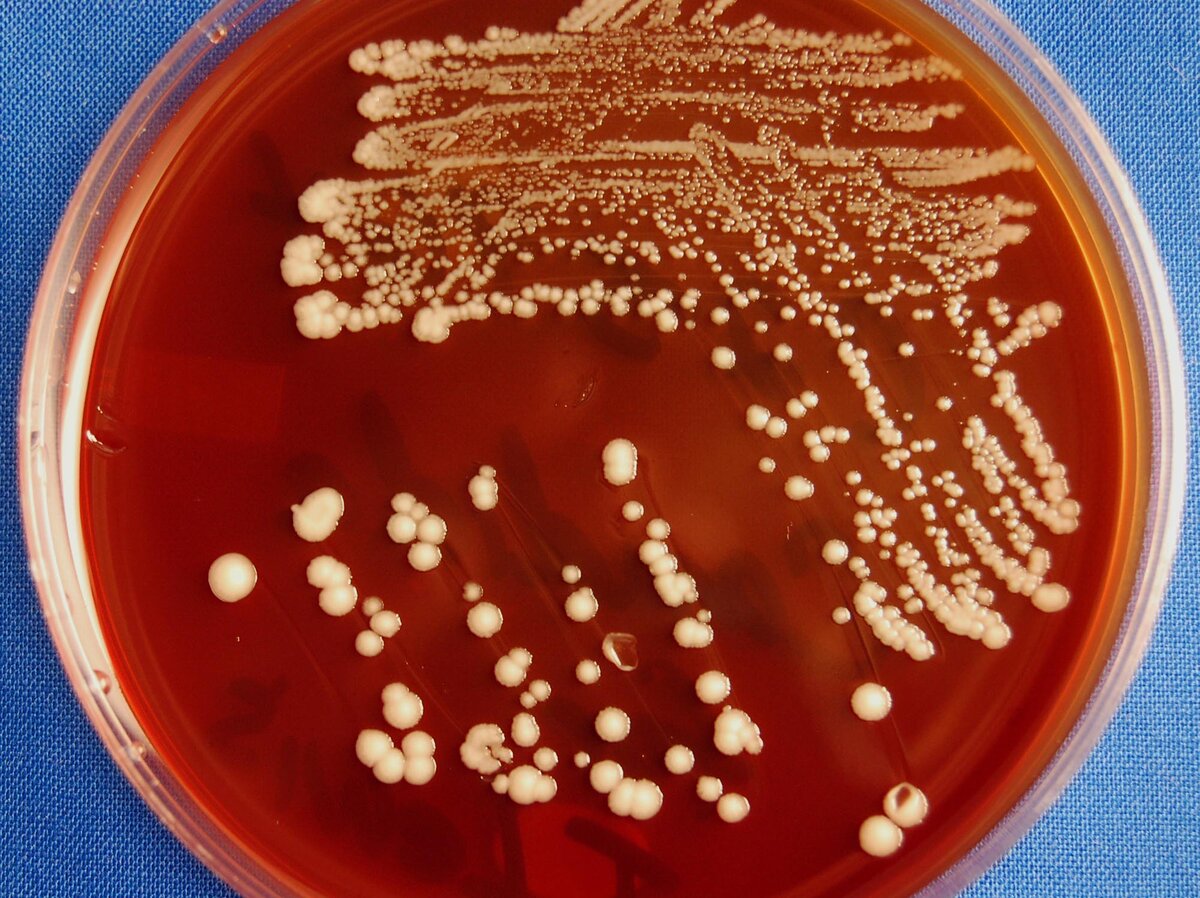 Candida SPP микробиология. Дрожжеподобный гриб Candida albicans.