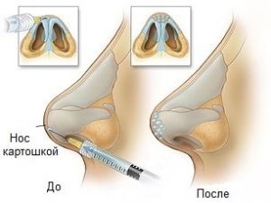 Молодость пациента — до 18 лет операцию делать не желательно;