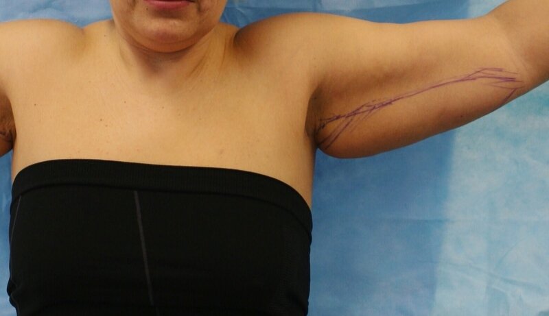 Кому-то больше нравятся тоненькие ручки, кто-то любит мышечный рельеф, но обвисшие, неухоженные и #дряблые руки , не будут привлекательны не для кого.