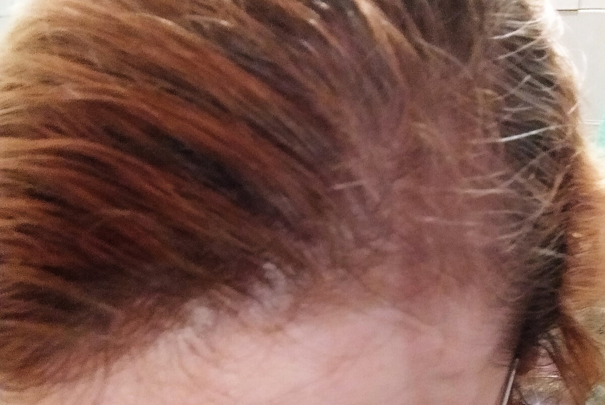 Личное фото.