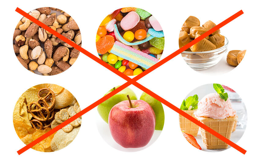 Запрещенные продукты при лечении на брекет-системе.