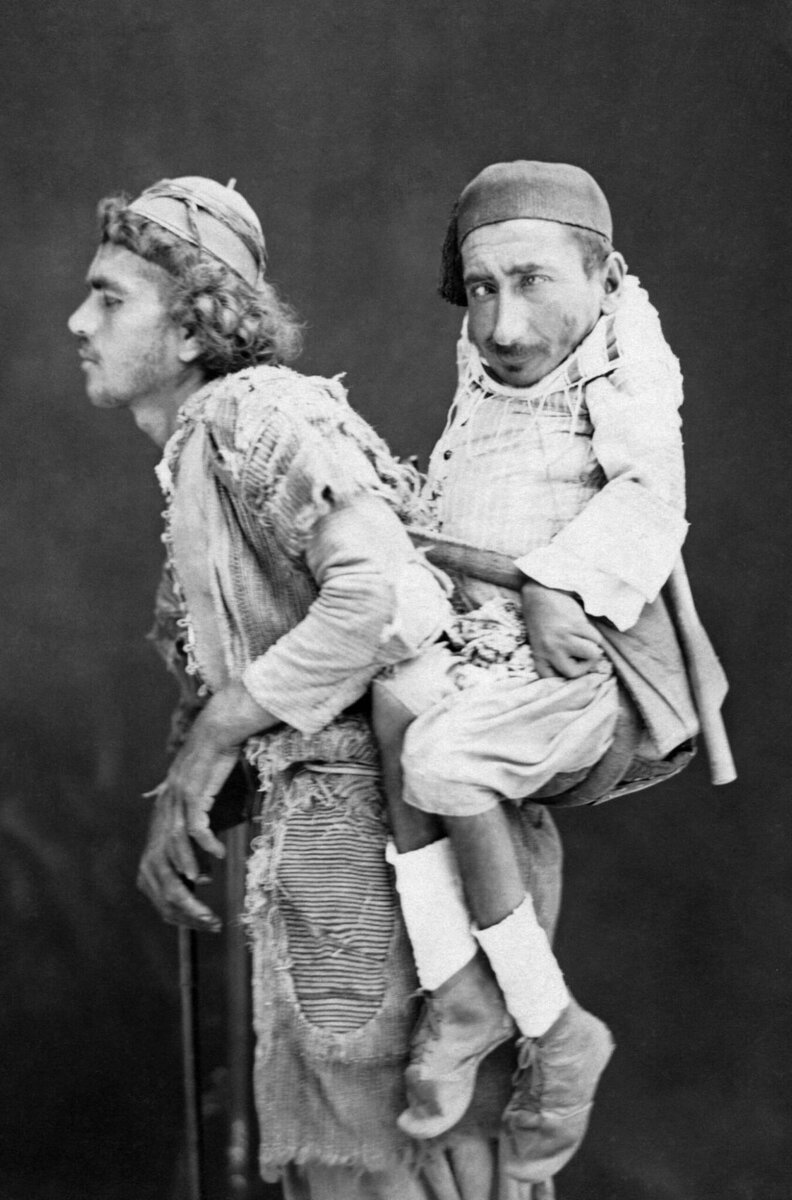 Одна из самых странных и красивых фотографий, сделанных в Сирии в 1889 году. На фото запечатлены два человека - слепой мусульманин Мохаммед и парализованный карлик христианин Самир. История жизни этих людей могла бы показаться притчей, если не была бы правдой. Сегодня уже никто и не знает, как свела судьба потерявшего зрение мусульманина Мохаммеда и христианина Самира, который родился карликом и был разбил параличом. До нашего времени дошло лишь то, что оба они были сиротами и жили под одной крышей. Каждое утро Мохаммед сажал за спину своего не ходящего друга Самира, и они шли по улицам, чтобы как-​то заработать и не пропасть в этом жестоком мире. Мохаммед и Самир были не просто друзьями, они были ногами и глазами друг для друга. Говорят, когда умер карлик Самир, слепой мусульманин Мохаммед был настолько опечален смертью своего товарища, что через неделю от горя и сам ушёл в мир иной. 
