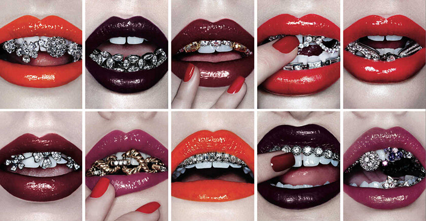 Грилзы – это декоративные накладки на зуб или несколько зубов, сделанных из простого и драгоценного металла с инкрустацией различными украшениями (стеклом, эмалью, стразами и драгоценными камнями). Они могут быть разных размеров и выполнены в разных стилях.
С английского «grills» переводится как решетка, что полностью отражает суть этого украшения на зубы. Грилзы – съемная конструкция, которая строением очень похожа на брекеты, но есть одно главное различие. Грилзы выглядят как накладные металлические зубы, что иногда смотрится не очень эстетично. 
Качественно выполненные грилзы не причиняют вреда зубной эмали, так как внутри накладки размещены специальные силиконовые полоски, которые оберегают эмаль от соприкосновения с металлом. Кроме этого, грилзы имеют небольшие зажимы, которые надежно удерживают аксессуар на зубах.
Разновидности грилзов GrillzГриллзы изготавливаются индивидуально, после консультации со стоматологом. На приеме врач делает слепок челюсти, чтобы грилзы не доставляли дискомфорта и плотно прилегали к зубам. Именно такие украшения на зубы можно назвать качественными.

Грилзы, которые изготавливаются не под заказ могут нанести вред зубам!

Поскольку ограничений в дизайне практически нет, появилось множество видов грилзов, которые отличаются материалом и способом крепления.

Штамповые грилзы изготавливаются из недорого металла. Они не плотно прилегают к зубам. Но чтобы минимизировать неудобство производители делают их довольно гибкими, чтобы клиент мог сам придать им нужную форму по зубной дуге. Крепятся такие украшения за стальные зажимы на дальних зубах. Эти крепления не только царапают зубную эмаль, но и могут стать причиной развития кариеса.

Грилзы из сплава хрома и никеля являются самыми распространенными украшениями на зубы. Сплав не вредит микрофлоре полости рта и подходит для изготовления грилзов на заказ. Кроме этого, цена за такие грилзы довольно демократична.

Серебряные грилзы. Украшения из серебра считаются самыми безопасными для зубов, особенно если сделаны по индивидуальному слепку. Серебро обладает антисептическими свойствами, если правильно ухаживать за украшением и соблюдать правила гигиены. Некоторые люди утверждают, что серебряные грилзы помогают сохранить свежесть дыхания.

Золотые грилзы распространены среди звезд шоу-бизнеса и обеспеченных людей. Золотые грилзы украшают драгоценными камнями и делают их самой разной формы.

Грилзы можно разделить и по способу крепления украшения к зубам. Самые дешевые грилзы крепятся к зубам с помощью воска. Воск находится внутри украшения и перед тем, как надеть, их необходимо опустить в горячую воду, чтобы воск немного подтаял. Только после этого грилзы устанавливаются на зубы. Такой способ крепления не надежен, а иногда опасен. Поскольку воск может растаять во время ношения (перепад температур, горячее питье) и грилзы просто слетят. При этом если грилзы надеваются на один зуб, то его просто можно проглотить.

Грилзы, изготовленные на заказ имеют внутри специальное покрытие, которое безопасно для зубов. А также такие грилзы повторяют форму зубов и удобно сидят на зубном ряду.
Как носить грилзы В отличие от скайсов грилзы не требуют в установке помощи стоматолога. Их можно надевать и снимать самостоятельно.

Грилзы не рекомендуется носить длительное время. А при ношении нужно соблюдать простые правила:

Перед установкой украшения необходимо почистить зубы.
В грилзах нельзя употреблять пищу, так как частички еды могут попасть под грилзы и повредить не только эмаль, но и силиконовую накладку.
Во время ношения грилзы нельзя трогать руками и языком. Такие манипуляции могут сдвинуть украшение с места, что приведет к дискомфорту и повреждению эмали зубов.

Уход за грилзами
Чтобы грилзы долго прослужили необходимо за ними правильно ухаживать. После каждой носки нужно чистить силиконовые присоски и внешнюю часть украшения мягкой зубной пастой. Лучше всего пасту наносить на ватную палочку, чтобы не поцарапать грилзы.

Хранить грилзы необходимо в сухом виде и сухом месте, лучше всего в мягкой ткани.

Минусы
ГриллзыГрилзы, хоть и носят чисто эстетический характер, могут нанести непоправимый вред зубам и ротовой полости. В первую очередь это связано с некачественными материалами, из которых изготавливают дешевые модели.

Некоторые металлы могут вызвать аллергическую реакцию, выражающуюся в жжении, припухлости и кровоточивости десен.

После нескольких носок может появиться стоматит или воспаление слизистой оболочки.

У некоторых людей наблюдается воспаление пародонта и механические повреждения зубов. Часто грилзы вызывают кариес.

Грилзы сложной формы часто приводят к повреждениям губ, языка и десен. Кроме этого, на губах может появиться раздражение из-за камней в грилзах.

Длительное ношение украшений на зубах приводит к стиранию зубов и истончению эмали. Кроме этого, постоянное ношение может изменить прикус, особенно если грилзы не изготовлены по специальному заказу.

Помните, что при первых признаках дискомфорта, боли, раздражении, кровоточивости и воспаления необходимо в срочном порядке обратиться к стоматологу.

Только грилзы изготовленные по индивидуальному слепку с применением качественных материалов не принесут вреда и будут полностью безопасны.

Стоимость
Купить грилзы можно двумя способами – заказать у стоматолога или приобрести через интернет.

Стоимость индивидуальных грилзов зависит от профессионализма и опыта ортодонта, а также от используемых материалов. Так, грилзы могут обойтись от нескольких тысяч рублей до весьма внушительной суммы. Самые дорогие грилзы были сделаны для американского хип-хоп исполнителя Lil Wayne. Грилзы обошлись ему в 150 000 долларов.

В интернете много сайтов с предложениями о покупке самых разнообразных грилзов. Их стоимость варьируется от 300 до 50 000 рублей. Но покупая грилзы через интернет, вы рискуете купить некачественную продукцию.
