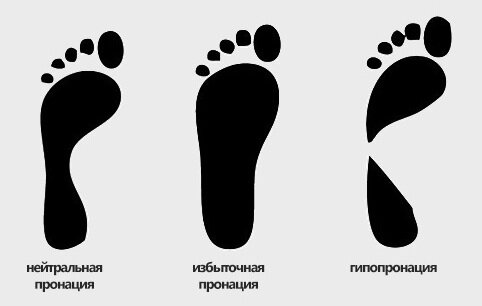Пронация и гиперпронация стопы: почему это важно для выбора кроссовок?