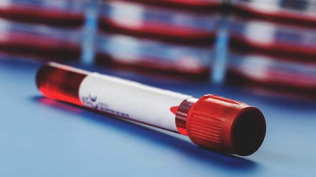 Уровень глюкозы в венозной крови у здорового человека после еды должен быть 4,1-6,3 ммоль/л