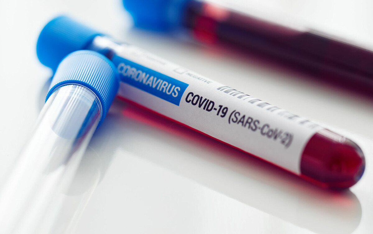 История моей болезни коронавирусной инфекции