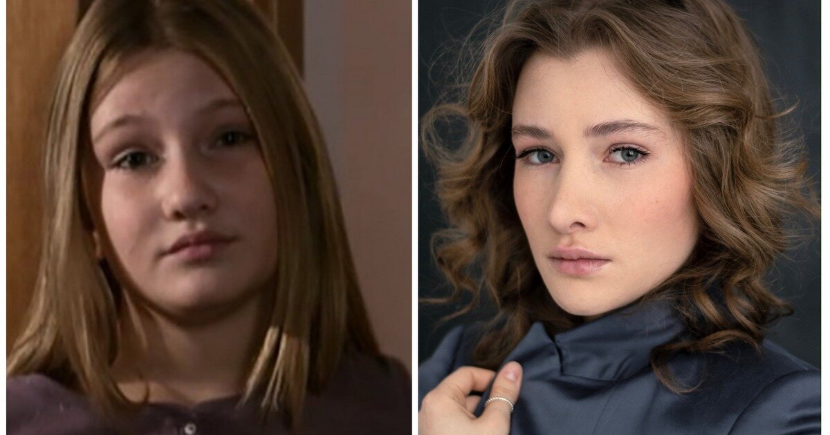 Хилькова актриса до и после пластики