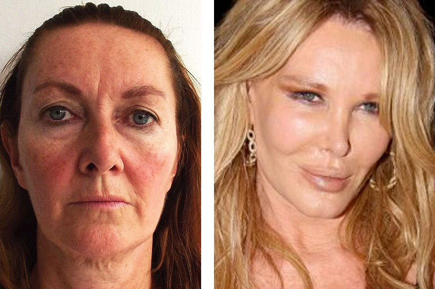 хью грант фото. бывший плохо выглядит. хью грант улыбка. почему русские женщины плохо выглядят. волочкова анастасия сейчас 2020.