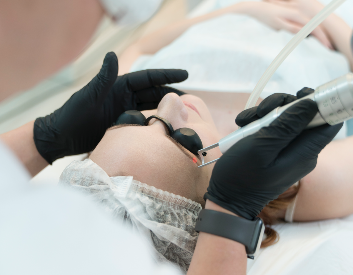 Как влияет лазер на волоски?