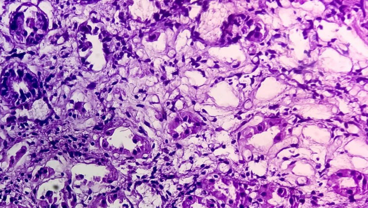 Гистологический слайд образца ткани под микроскопом