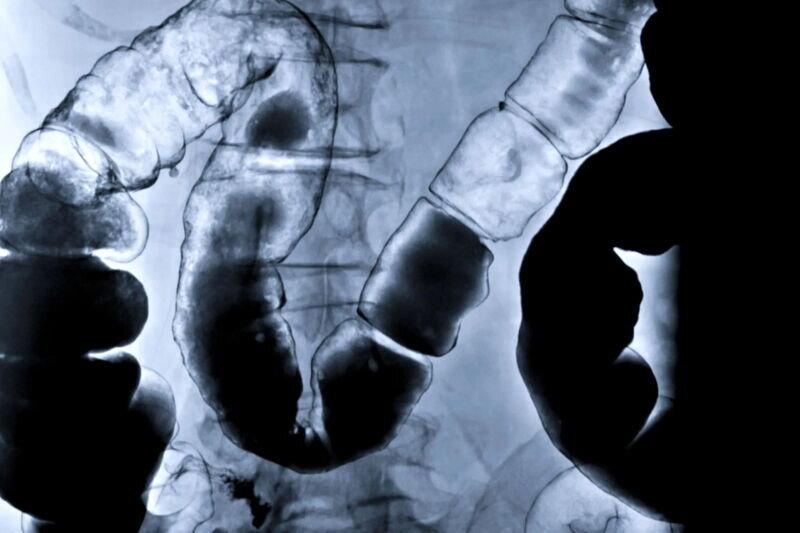     Внутри мышей вырастили маленькие человеческие кишки