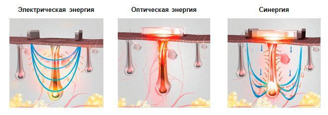Воск и шугаринг – необычные способы позаботиться о коже